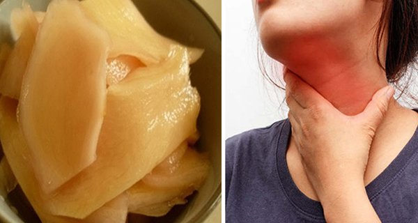 Món ăn chữa dứt chứng trào ngược dạ dày, ngăn ngừa K thực quản, rất rẻ tiền lại dễ làm