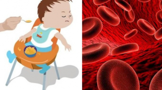 Trẻ thiếu máu rất nguy hiểm, nếu thấy con có 5 biểu hiện này cha mẹ không được chủ quan